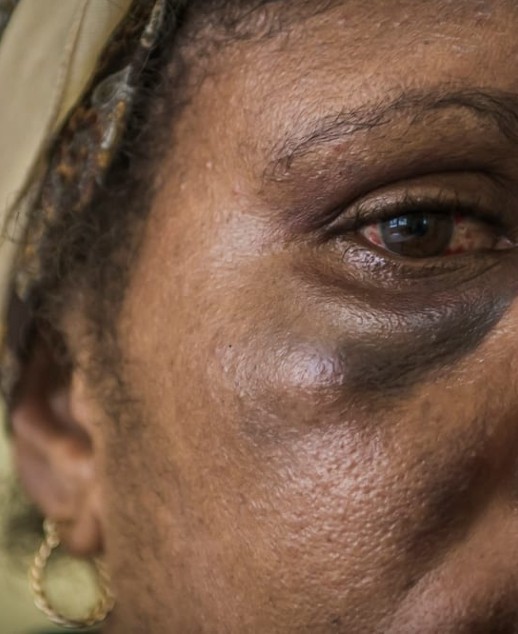 Gender Based Violence